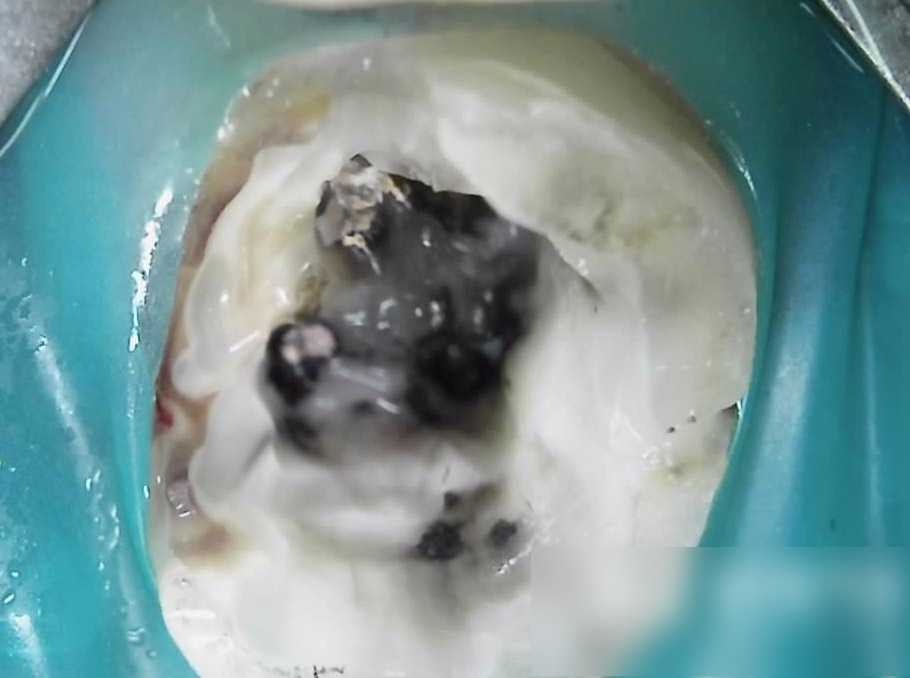 Treatment case image 4