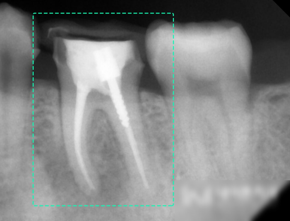 Treatment case image 7