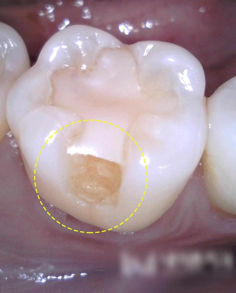 Treatment case image 1