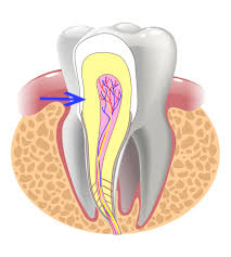 Treatment case image 2