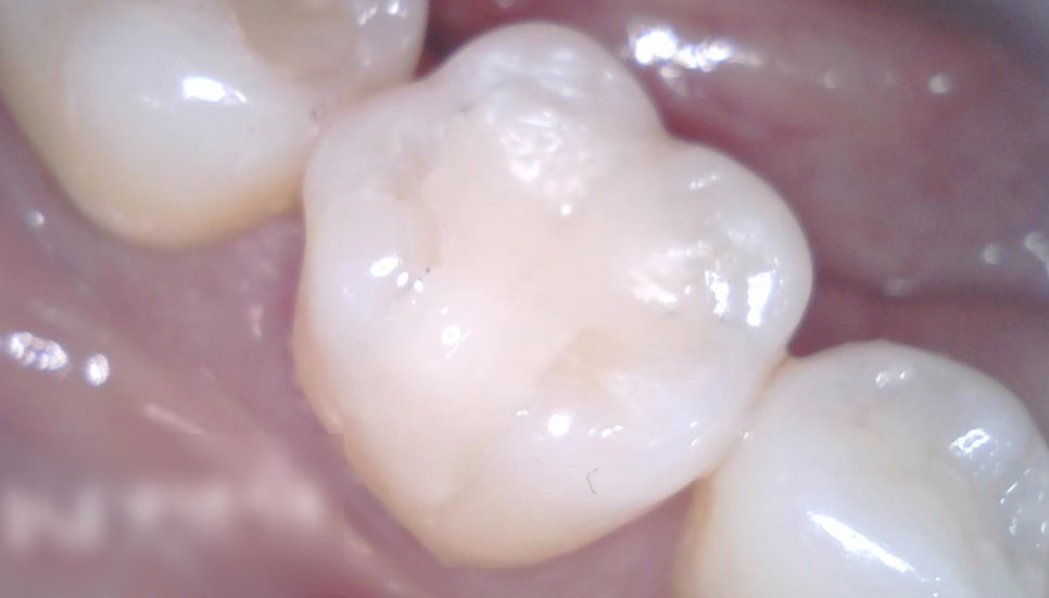 Treatment case image 5