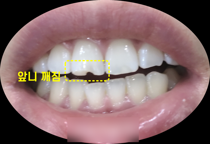 Treatment case image 1