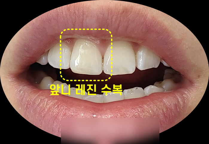 Treatment case image 3