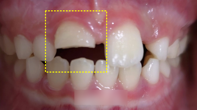 Treatment case image 1