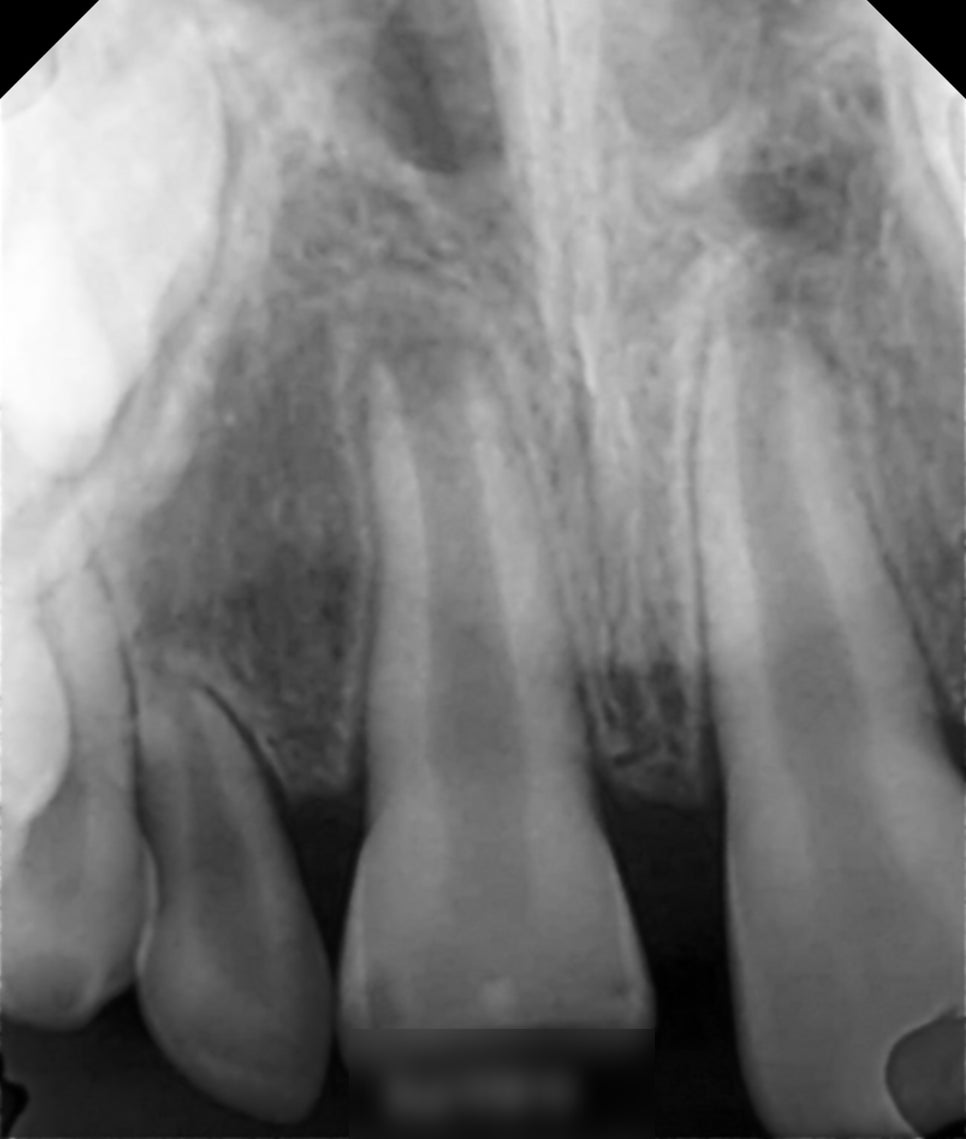 Treatment case image 2
