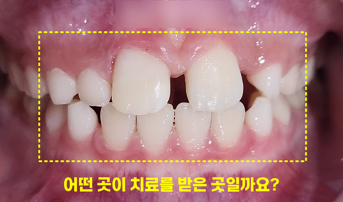 Treatment case image 5