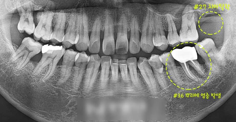 Treatment case image 1