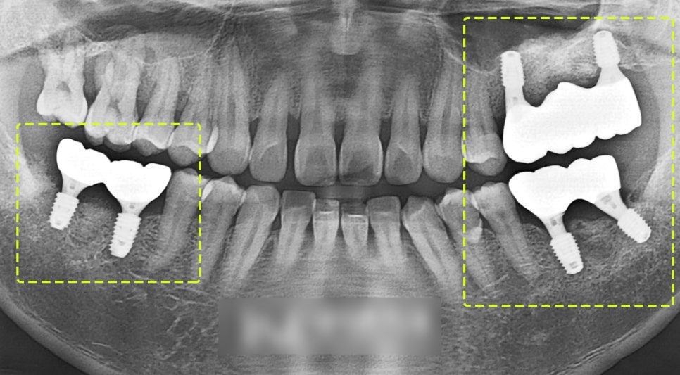 Treatment case image 2