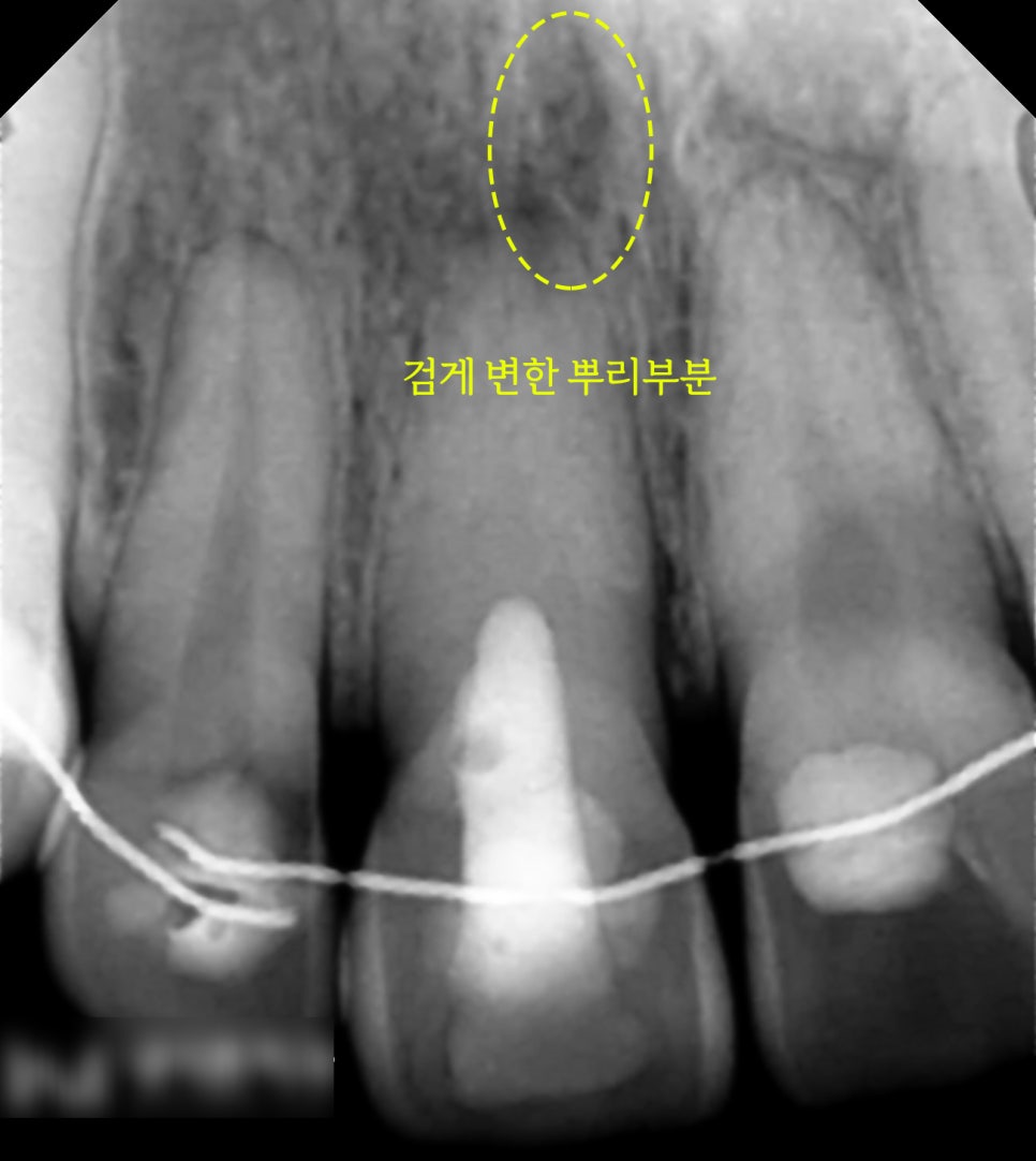 Treatment case image 1