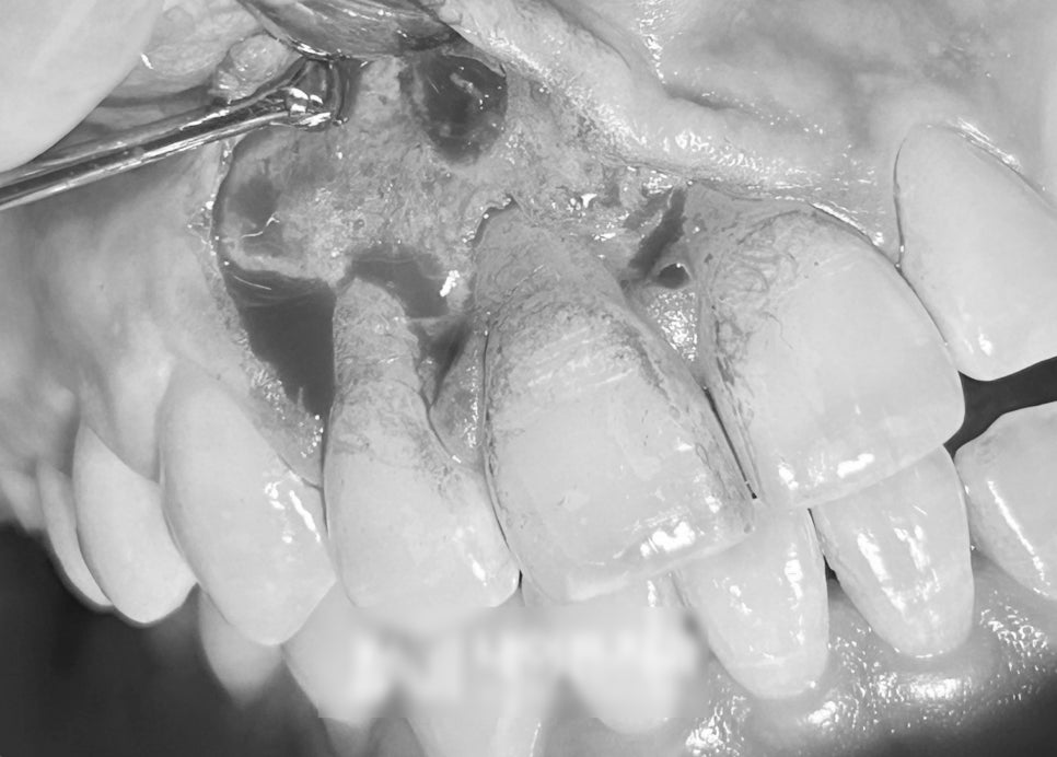 Treatment case image 3