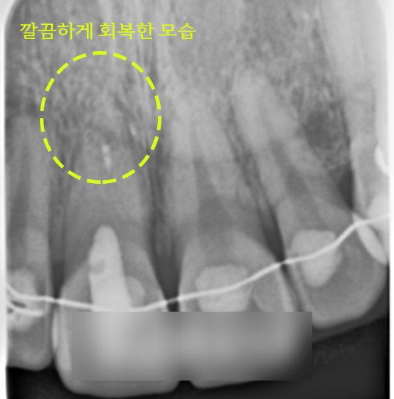 Treatment case image 4