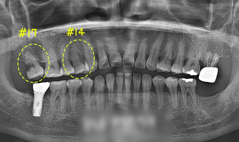 Treatment case image 1