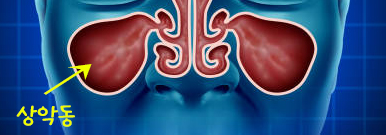 Treatment case image 2