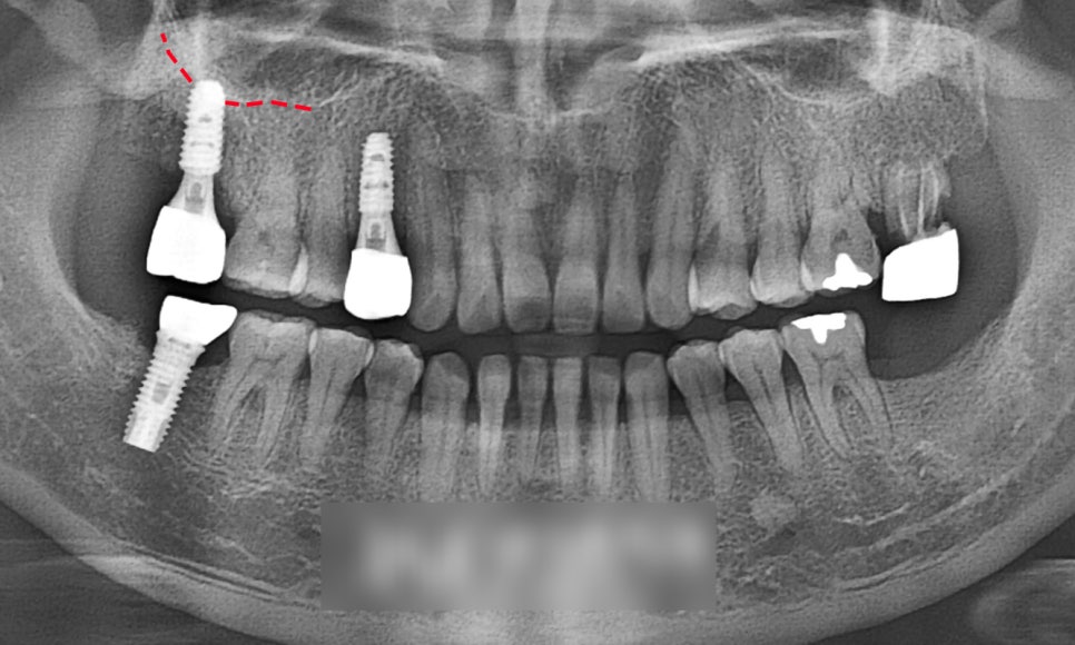 Treatment case image 5