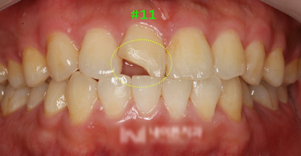 Treatment case image 1