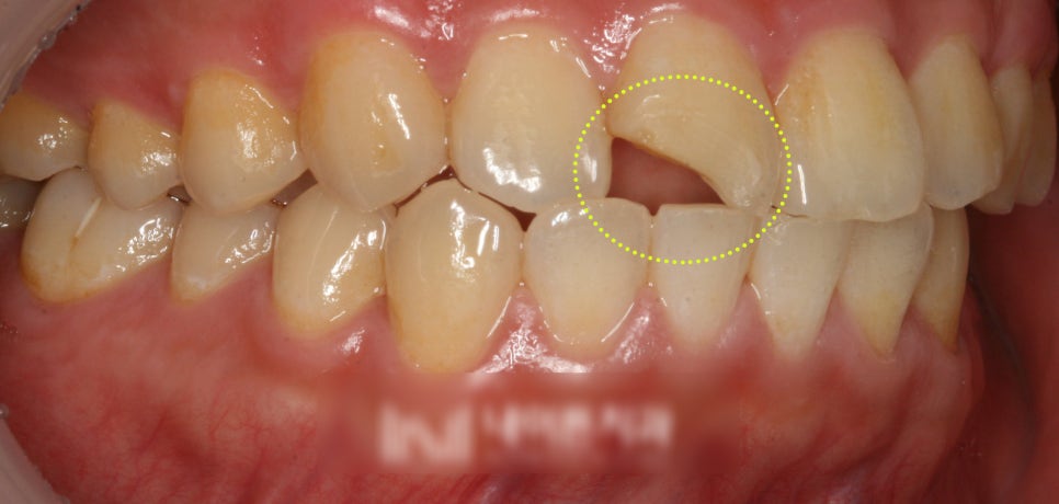 Treatment case image 2
