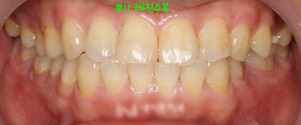 Treatment case image 5