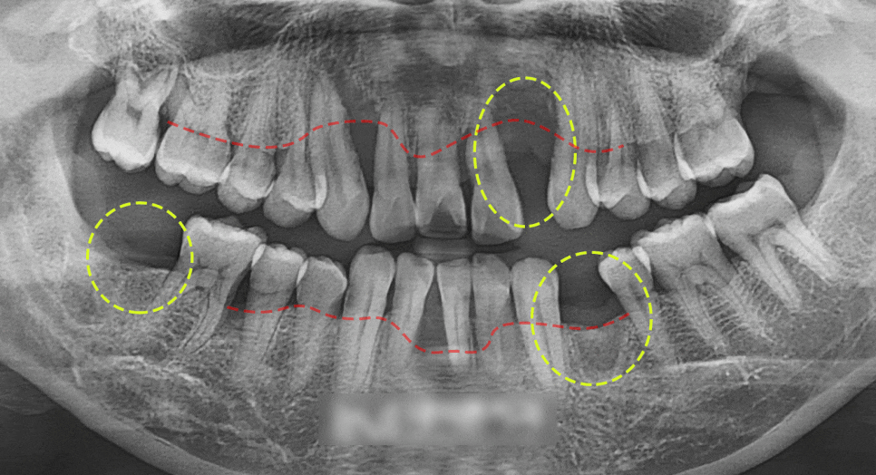 Treatment case image 1