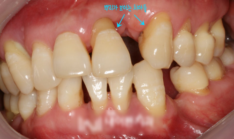 Treatment case image 2
