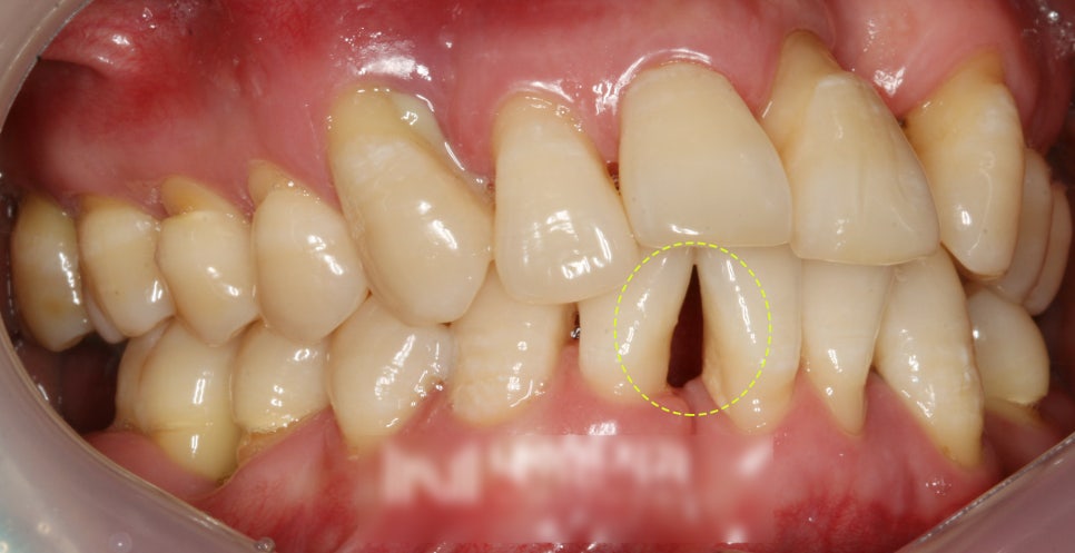 Treatment case image 5