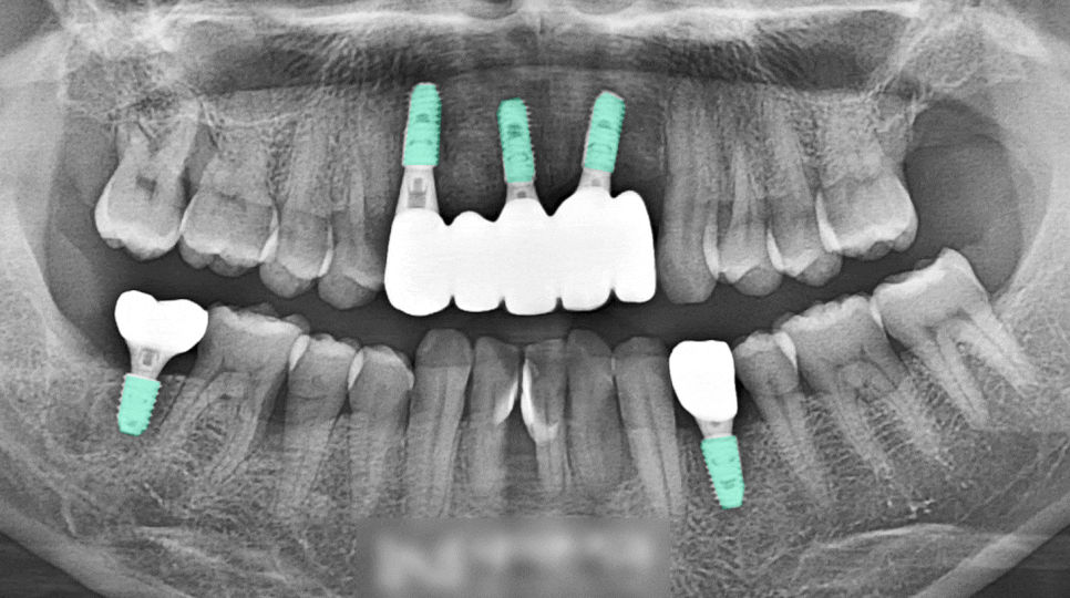 Treatment case image 7