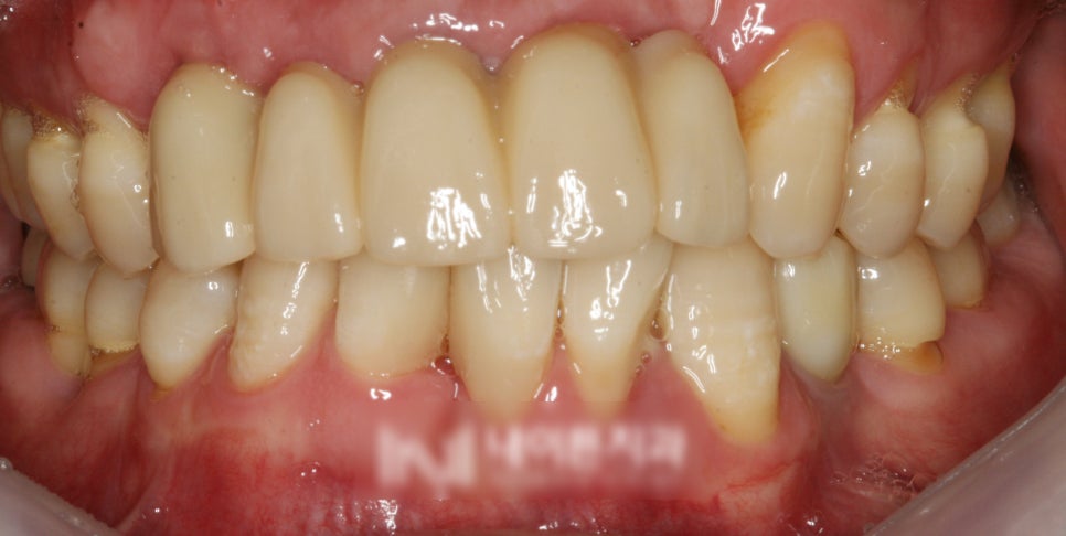 Treatment case image 8