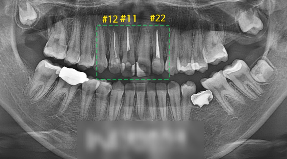 Treatment case image 1