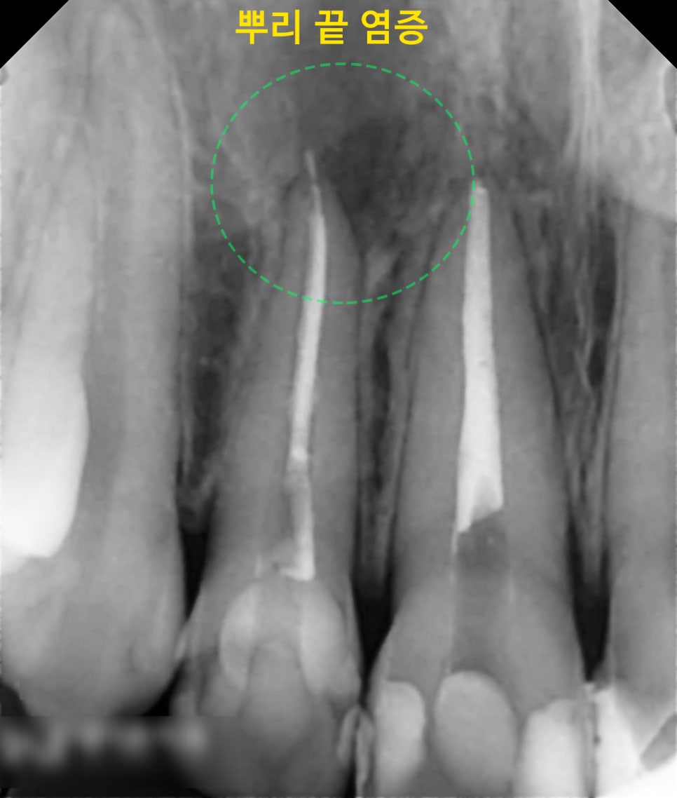 Treatment case image 2