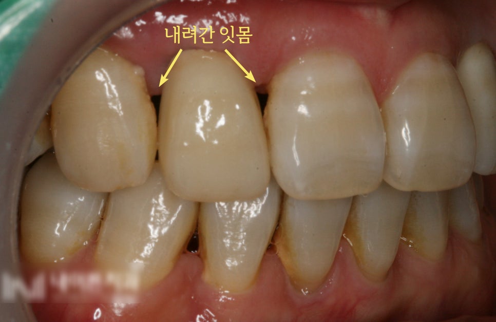 Treatment case image 3