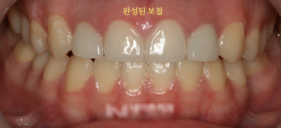 Treatment case image 7
