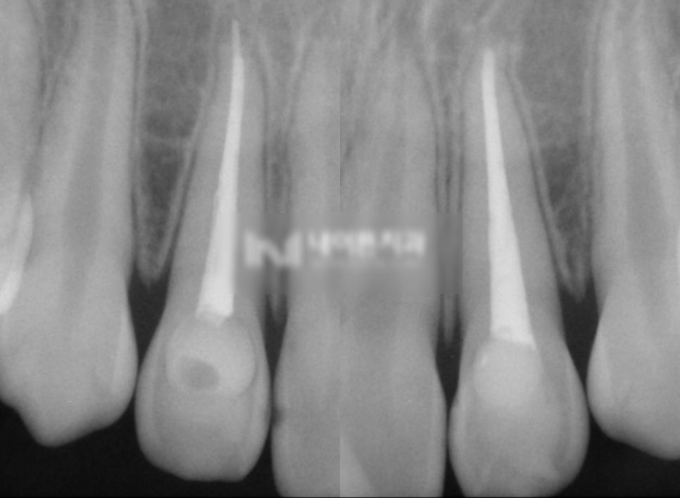 Treatment case image 8