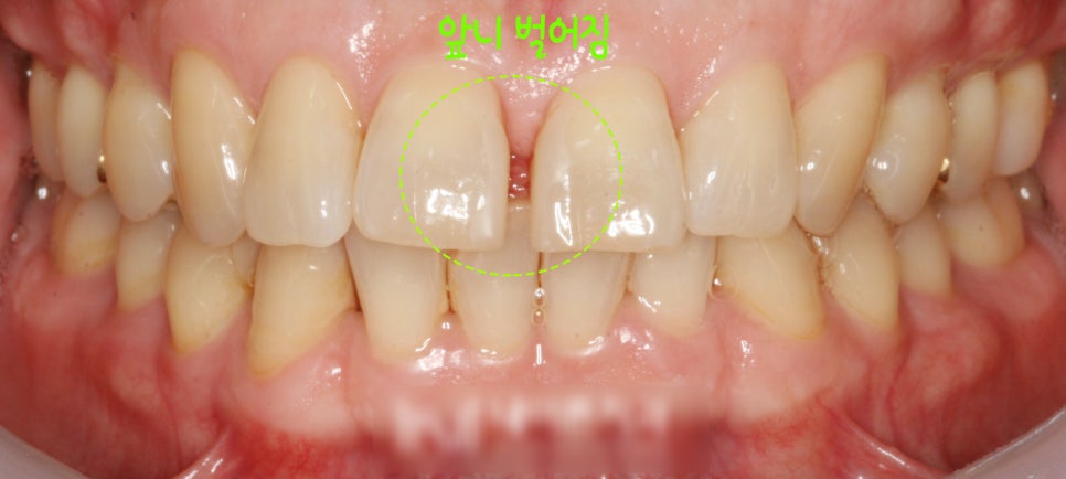 Treatment case image 1