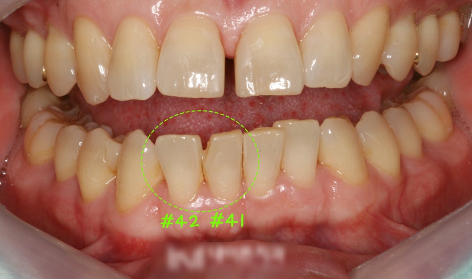 Treatment case image 2