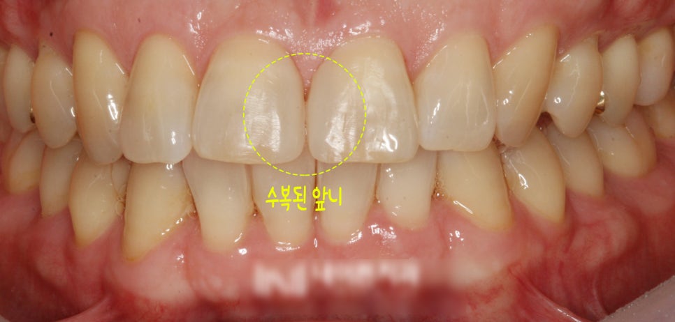 Treatment case image 5