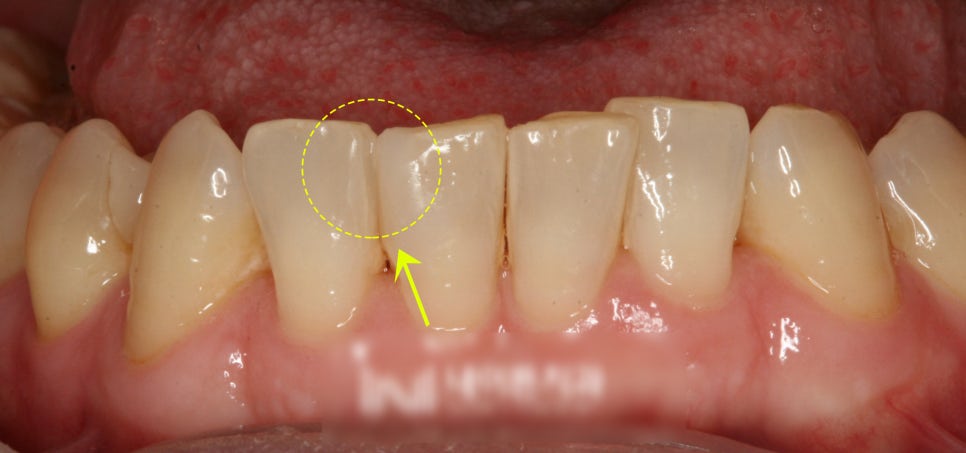 Treatment case image 6
