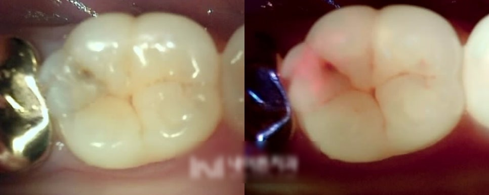 Treatment case image 1