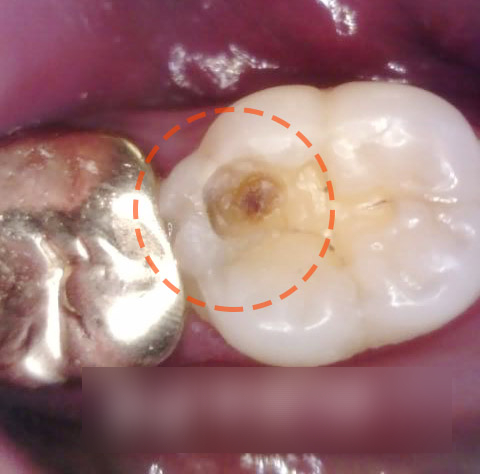 Treatment case image 2