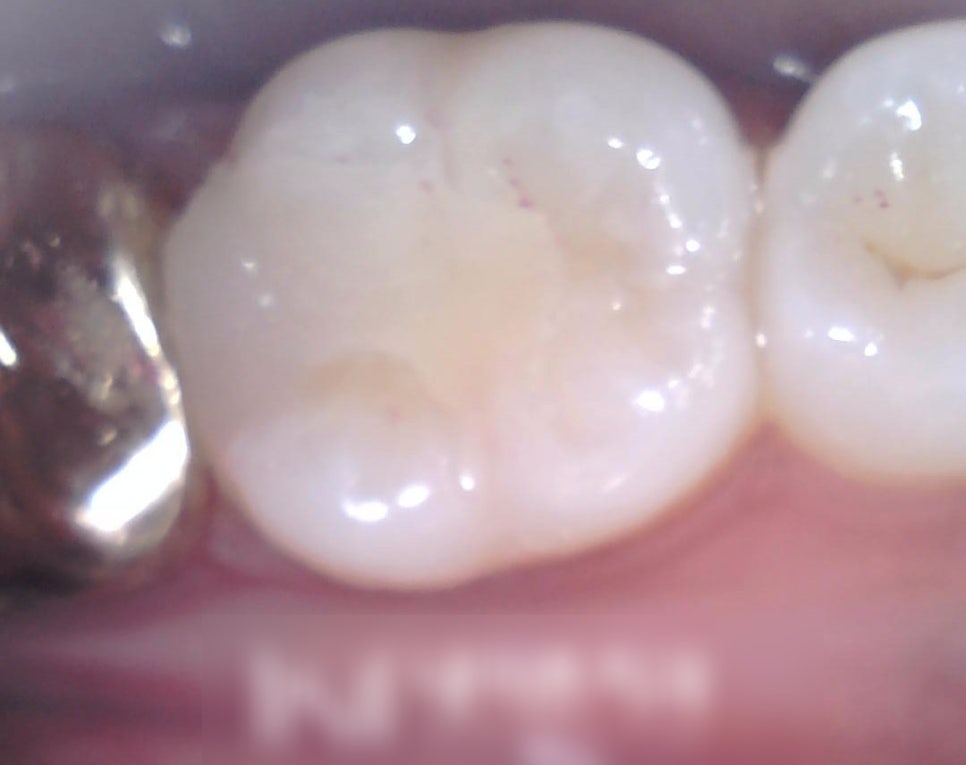 Treatment case image 3