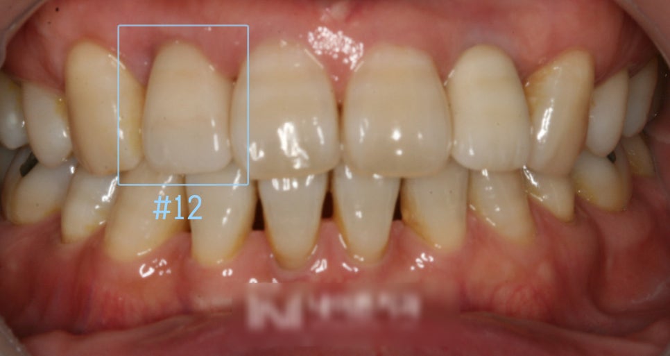 Treatment case image 1