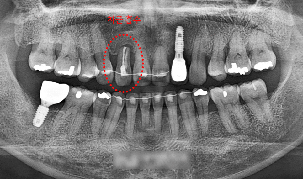 Treatment case image 2