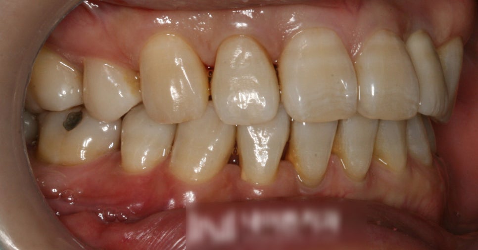 Treatment case image 5