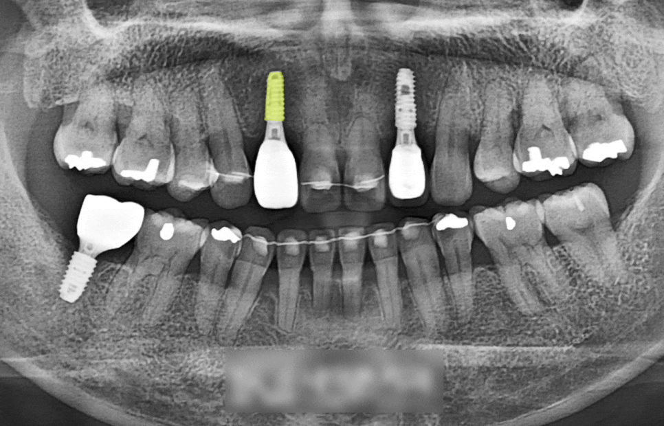 Treatment case image 6