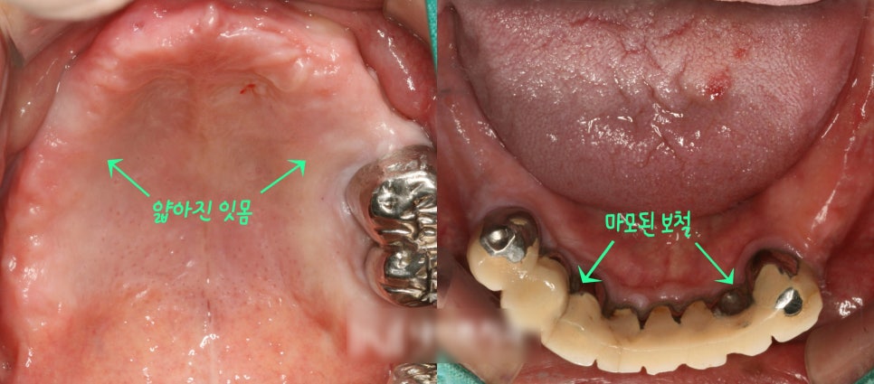 Treatment case image 1