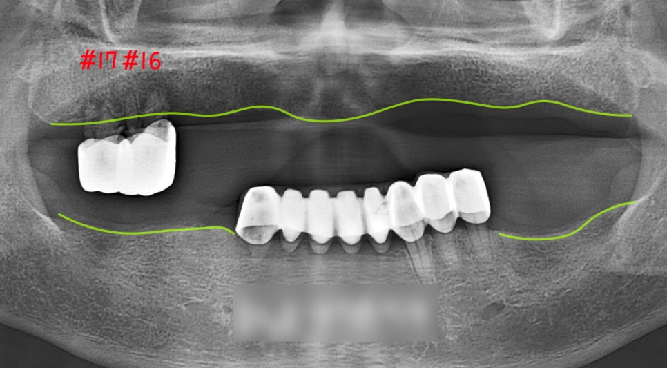Treatment case image 2