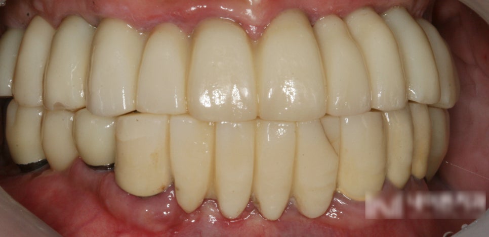 Treatment case image 5