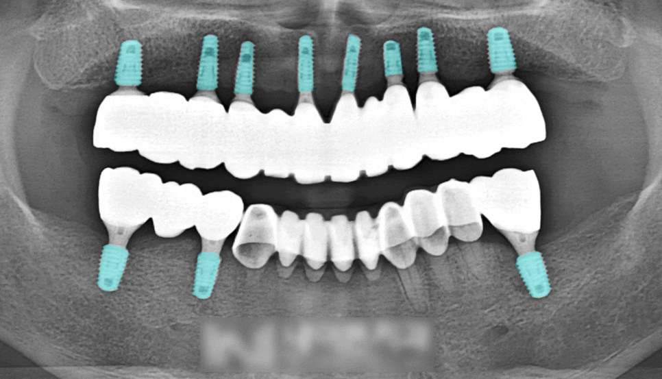 Treatment case image 6