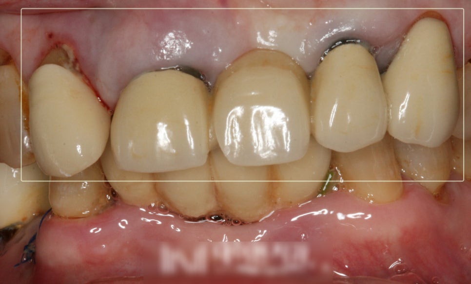 Treatment case image 1