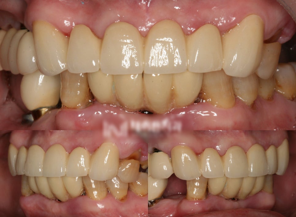 Treatment case image 2