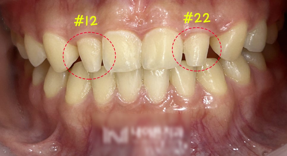 Treatment case image 1