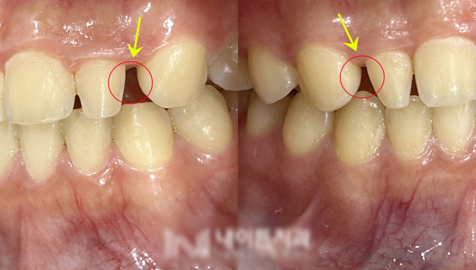 Treatment case image 2